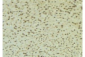 ABIN6277622 at 1/100 staining Mouse muscle tissue by IHC-P. (TLE1 antibody  (Internal Region))