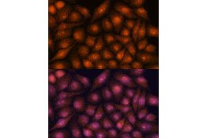 Immunofluorescence analysis of HeLa cells using DDX31 antibody (ABIN7266695) at dilution of 1:100. (DDX31 antibody  (AA 652-851))
