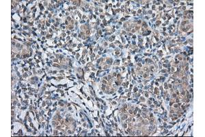 Immunohistochemical staining of paraffin-embedded Human Kidney tissue using anti-TBXAS1 mouse monoclonal antibody. (TBXAS1 antibody)