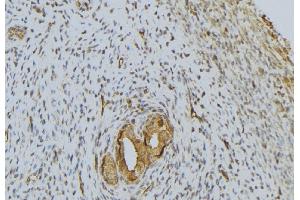 ABIN6276642 at 1/100 staining Human uterus tissue by IHC-P. (PRSS1 antibody  (Internal Region))