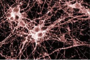 Immunofluorescence staining of cortical neurons. (Metabotropic Glutamate Receptor 1 antibody  (AA 1042-1160))