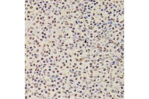 Immunohistochemistry (Paraffin-embedded Sections) (IHC (p)) image for anti-Acidic (Leucine-Rich) Nuclear phosphoprotein 32 Family, Member A (ANP32A) (AA 1-170) antibody (ABIN6136909)