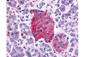Anti-SSTR2 antibody IHC of human pancreas, islet of Langerhans. (SSTR2 antibody  (C-Term))