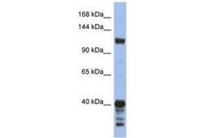 Image no. 1 for anti-Signal-Induced Proliferation-Associated 1 (SIPA1) (AA 863-912) antibody (ABIN6744322)