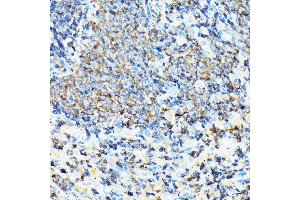 Immunohistochemistry of paraffin-embedded mouse spleen using CORO1A Rabbit pAb (ABIN6133495, ABIN6138903, ABIN6138904 and ABIN6224969) at dilution of 1:100 (40x lens).