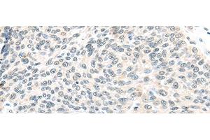 Immunohistochemistry (Paraffin-embedded Sections) (IHC (p)) image for anti-Transcription Elongation Factor B (SIII), Polypeptide 1 (15kDa, Elongin C) (TCEB1) antibody (ABIN7244036)