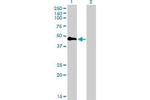Western Blot analysis of TNFRSF19 expression in transfected 293T cell line by TNFRSF19 monoclonal antibody (M01), clone 2G4.