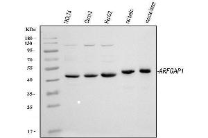 Western blot analysis of ARFGAP1 using anti-ARFGAP1 antibody (ABIN4886474). (ARFGAP1 antibody  (AA 1-183))