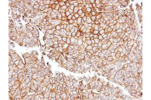 IHC-P Image Immunohistochemical analysis of paraffin-embedded PC13 xenograft, using GGT1, antibody at 1:100 dilution. (GGT1 antibody)