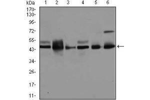 Western blot analysis using MAPK8 mouse mAb against A431 (1), K562 (2), HeLa (3), NIH3T3 (4), PC-12 (5), and MCF-7 (6) cell lysate.