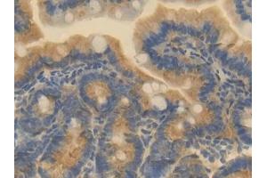 Detection of ESAM in Mouse Small intestine Tissue using Polyclonal Antibody to Endothelial Cell Adhesion Molecule (ESAM) (ESAM antibody  (AA 29-248))
