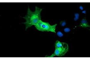 Anti-CALCOCO2 mouse monoclonal antibody (ABIN2453988) immunofluorescent staining of COS7 cells transiently transfected by pCMV6-ENTRY CALCOCO2 (RC203843). (CALCOCO2 antibody)