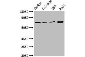 Western Blot Positive WB detected in: Jurkat whole cell lysate, Colo320 whole cell lysate, U87 whole cell lysate, Raji whole cell lysate All lanes: HSPA8 antibody at 1. (Recombinant Hsc70 antibody)