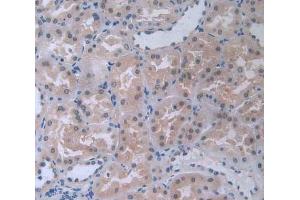 IHC-P analysis of kidney tissue, with DAB staining. (COL4a5 antibody  (AA 1461-1685))