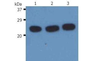 Western Blotting analysis (reducing conditions) of H-Ras in whole cell lysate using anti-H-Ras (H-RAS-03).