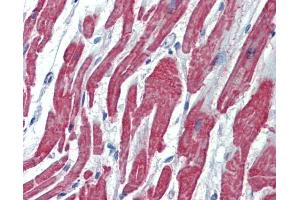IHC-P Image Immunohistochemical analysis of paraffin-embedded human heart, using Activin A Receptor Type II-like 1, antibody(20 μg/ml). (ACVRL1 antibody  (C-Term))