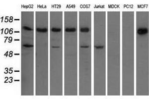 Western blot analysis of extracts (35 µg) from 9 different cell lines by using anti-IGF2BP2 monoclonal antibody. (IGF2BP2 antibody)