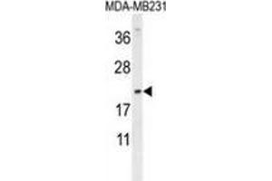 Western blot analysis in MDA-MB231 cell line lysates (35ug/lane) using DMRTC1 Antibody (N-term). (DMRTC1 antibody  (N-Term))