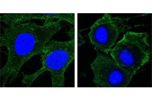Confocal immunofluorescence analysis of Hela (left) and HepG2 (right) cells using KDR mouse mAb (green). (VEGFR2/CD309 antibody  (AA 20-764))