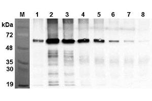 Immunoprecipitation of recombinant human FTO proteins using anti-FTO (human), mAb (AG103)  at different concentrations. (FTO antibody)