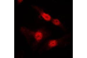 Immunofluorescent analysis of DGK alpha staining in MDCK cells. (DGKA antibody  (Center))