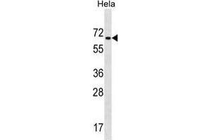 ZNF35 Antibody (Center) western blot analysis in Hela cell line lysates (35 µg/lane). (ZNF35 antibody  (Middle Region))