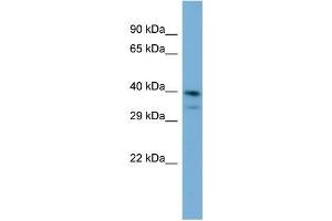 Host:  Rabbit  Target Name:  INPP5J  Sample Type:  Jurkat Whole Cell lysates  Antibody Dilution:  1.
