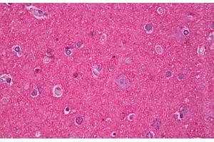 Immunohistochemistry (IHC) image for anti-Microtubule-Associated Protein tau (MAPT) antibody (ABIN957792)