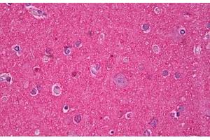 Anti-MAPT / Tau antibody IHC staining of human brain, cortex neuropil. (MAPT antibody)