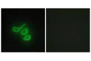 Immunofluorescence analysis of HepG2 cells, using M-CK antibody. (CKM antibody  (N-Term))