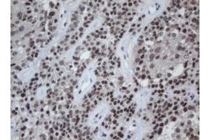 Image no. 1 for anti-Chromobox Homolog 8 (CBX8) (AA 1-260) antibody (ABIN1490663) (CBX8 antibody  (AA 1-260))