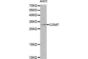 Western blot analysis of extracts of A431 cells lines, using COMT antibody. (COMT antibody  (AA 42-221))