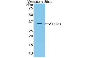 Western Blotting (WB) image for anti-serine Peptidase Inhibitor, Kazal Type 5 (SPINK5) (AA 734-995) antibody (ABIN1860612) (SPINK5 antibody  (AA 734-995))