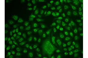 Immunofluorescence analysis of U2OS cell using TFPT antibody. (TFPT antibody)