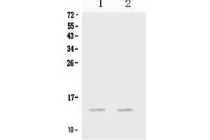 Western blot analysis of MIP-3 Alpha/CCL20 using anti-MIP-3 Alpha/CCL20 antibody .