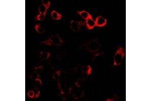 Immunofluorescent analysis of GLUR3 staining in U2OS cells.