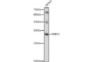 Western blot analysis of extracts of SKOV3 cells, using RSPO1 antibody (ABIN6132958, ABIN6147279, ABIN6147280 and ABIN6224304) at 1:1000 dilution. (RSPO1 antibody  (AA 21-263))