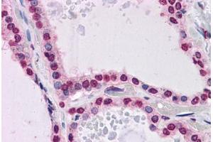 Human Thyroid: Formalin-Fixed, Paraffin-Embedded (FFPE) (KPNA7 antibody  (N-Term))