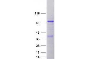 Validation with Western Blot