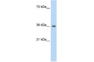 PHYHIP antibody used at 1. (PHYHIP antibody  (N-Term))