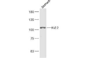 Rat Stomach lysates probed with Kv2. (Kv2.2 antibody  (AA 21-120))