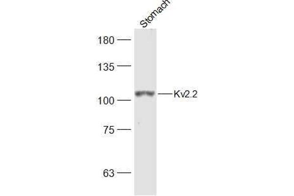 Kv2.2 抗体  (AA 21-120)