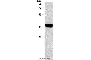 Western blot analysis of Mouse liver tissue, using ALDOB Polyclonal Antibody at dilution of 1:200