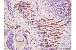 Formalin-fixed and paraffin embedded mouse embryo muscle labeled with Anti-TXLNB Polyclonal Antibody, Unconjugated (ABIN1386717) at 1:200, followed by conjugation to the secondary antibody and DAB staining