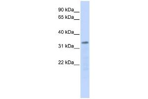 POLR3F antibody used at 1 ug/ml to detect target protein. (POLR3F antibody  (Middle Region))
