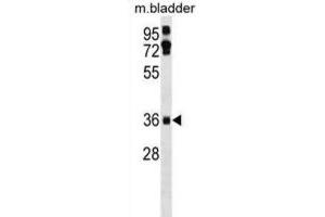 Western Blotting (WB) image for anti-Etoposide Induced 2.4 (EI24) antibody (ABIN3000878)