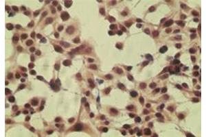 Image no. 2 for anti-Cylindromatosis (Turban Tumor Syndrome) (CYLD) (AA 32-45) antibody (ABIN200017) (CYLD antibody  (AA 32-45))