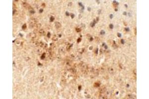 Immunohistochemical analysis of DRAXIN in mouse brain tissue with DRAXIN polyclonal antibody  at 5 ug/mL. (DRAXIN antibody  (C-Term))