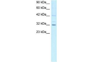 WB Suggested Anti-CCNH Antibody Titration:  1ug/ml  Positive Control:  Jurkat cell lysate CCNH is supported by BioGPS gene expression data to be expressed in Jurkat