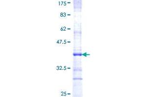 Image no. 1 for Prostaglandin E Receptor 3 (Subtype EP3) (PTGER3) (AA 1-90) protein (GST tag) (ABIN1316730) (PTGER3 Protein (AA 1-90) (GST tag))